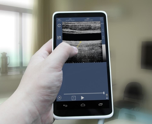 Ultrasound Scanner 6 inch 128 Elements Handheld Touch Screen Color Doppler Machine with convex/linear probe