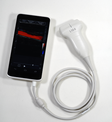 Ultrasound Scanner 6 inch 128 Elements Handheld Touch Screen Color Doppler Machine with convex/linear probe